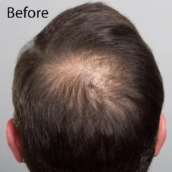 Sibel Hair Sculptor Hair Building Fibers - Dark Brown 25g -Pro Beauty Care Shop 817645 3